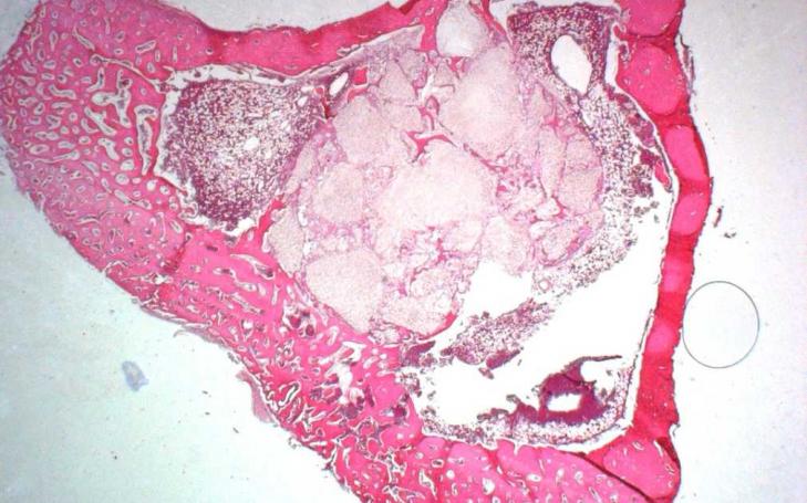 Más del 50% de la población sufrirá problemas osteoarticulares en 2020 Más del 50% de la población sufrirá problemas osteoarticulares en 2020