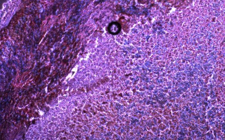 Una biomolécula, descubierta por Izpisua, ayuda al sistema inmunológico a superar el cáncer Una biomolécula, descubierta por Izpisua, ayuda al sistema inmunológico a superar el cáncer