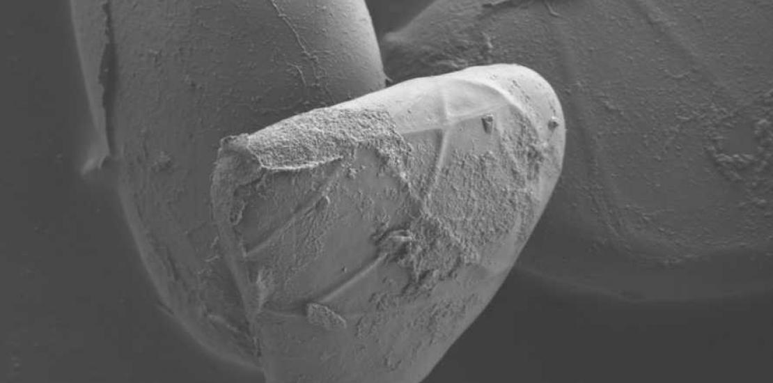 'InvestigArte 2015' expone una imagen capturada con el microscopio electrónico de barrido